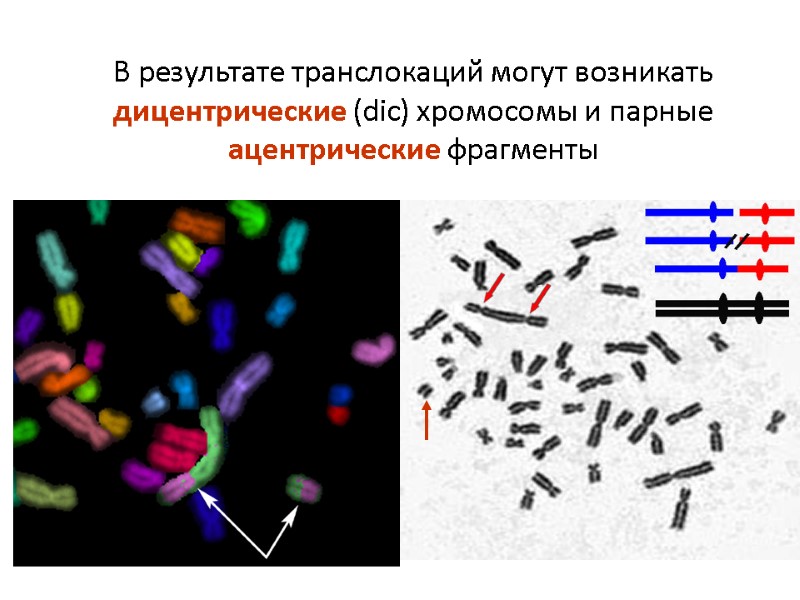 В результате транслокаций могут возникать дицентрические (dic) хромосомы и парные ацентрические фрагменты